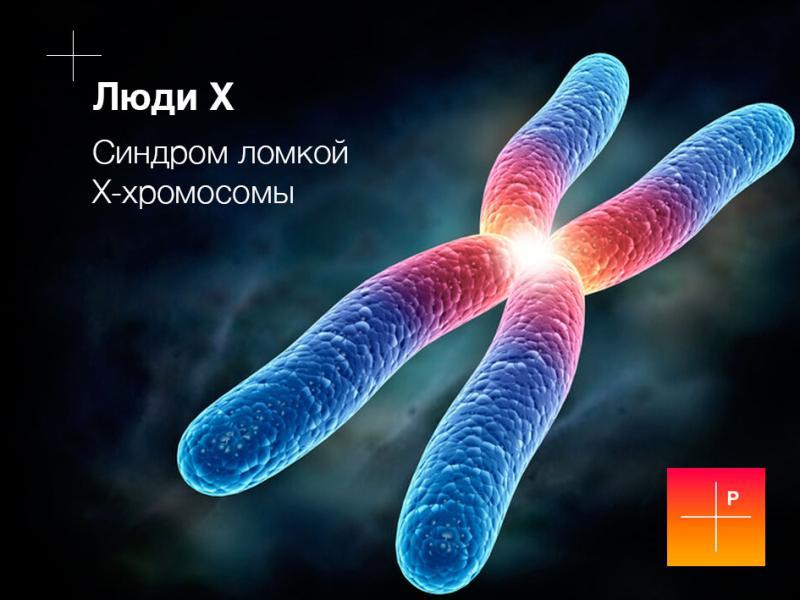 Люди X. Синдром ломкой X-хромосомы