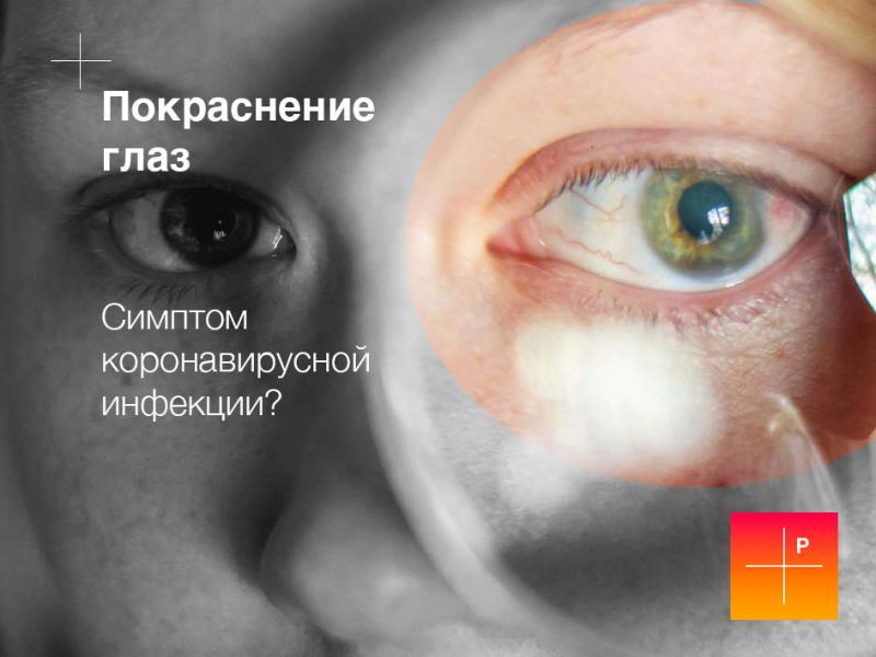 Красные глаза - симптомы какой болезни | Покраснение глаз — Клиника «Доктор рядом»
