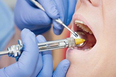 Анестезиология в стоматологии