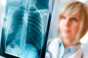 Лучевая диагностика туберкулеза органов дыхания для любого врача: что, зачем и почему