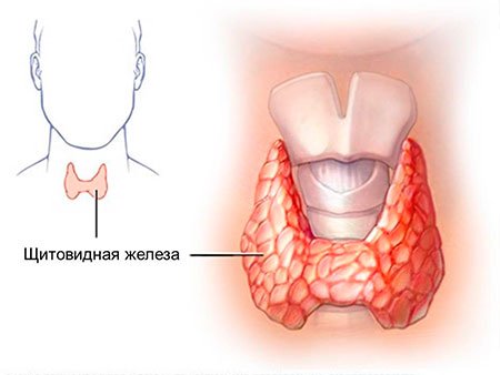 Головокружение при раке щитовидной железы